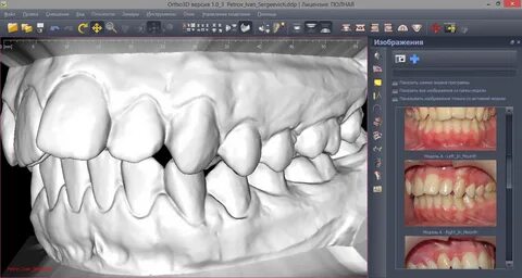 Ortho 3D" - Ortho 3D