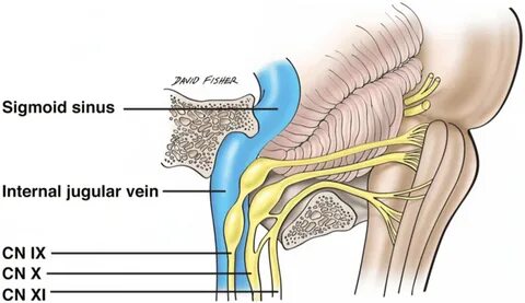 Right anterolateral view of the origin of the glossopharynge