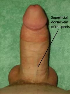File:Superficial dorsal vein of the penis (erect).png - Wiki