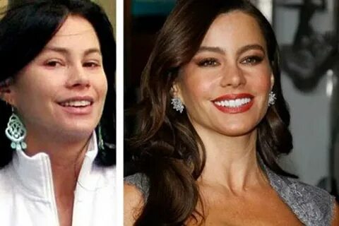 Sofia Vergara Before And After Surgery Popular