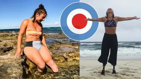 Auf Instagram - Unterhalb der Knie amputiert: Frau zeigt Stä