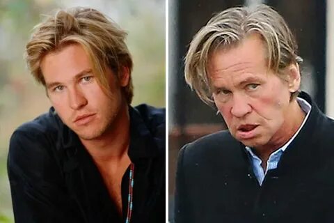 Val Kilmer Today Pic - diseasemart