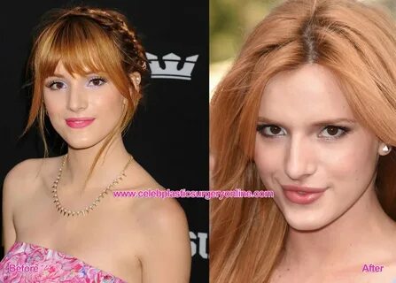 Bella Thorne plastic surgery for young Disney star?