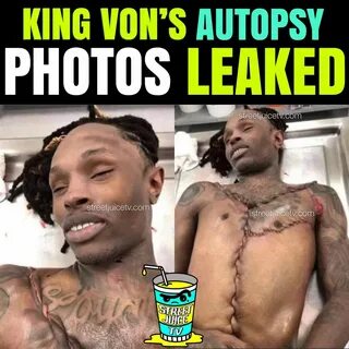 King Von Autopsy Photos Graphic Photos