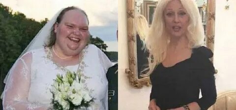 The Amazing Transformation Of "World’s Ugliest Bride" - Dail