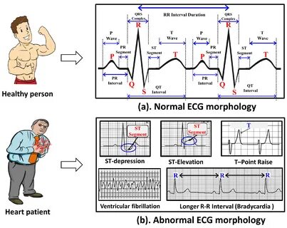 Sensors Free Full-Text On the Design of an Efficient Cardiac