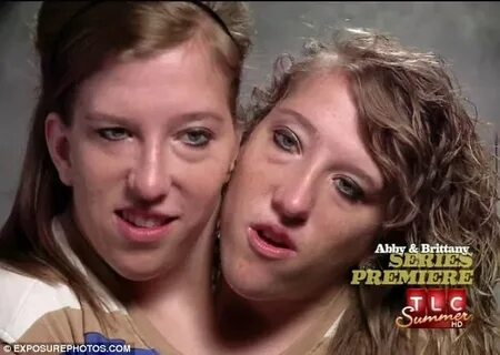 Conjoined twins Abigail and Brittany Hensel offer a glimpse 