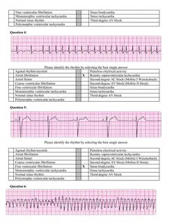 ACLS PRE-TEST ANNOTATED ANSWER KEY June, 2011