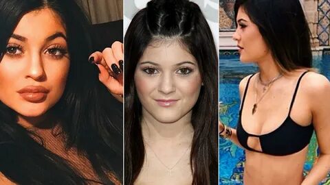 Did Kylie Jenner Get Plastic Surgery - Plastic Industry In T
