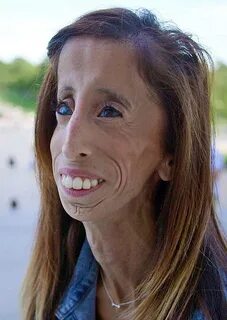 Review: 'A Brave Heart: The Lizzie Velasquez Story,' One Wom