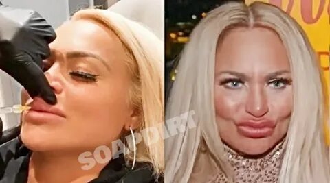 90 Day Fiance': Darcey Silva Gets More Lip Fillers - Check O