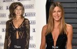 Jennifer Aniston Plastic Surgery Before and After Photos