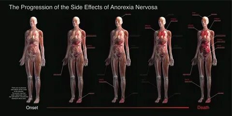 Side Effects of Anorexia on Behance