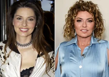 Shania Twain Plastic Surgery - With Before And After Photos