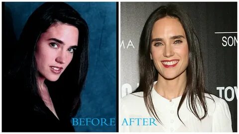 Jennifer Connelly Plastic Surgery (Before and After pics)