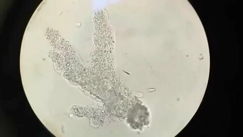 Under The Microscope: Blood 40x 100x 400x - NovostiNK
