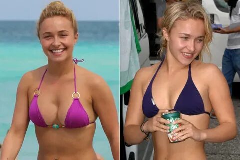 Hayden panettiere before and after boob job pics