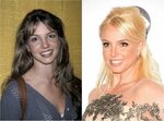 Celebrity Plastic Surgery: 30 Before-and-After Pics Celebrit