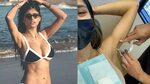 Mia Khalifa shares video of getting Botox injections for her
