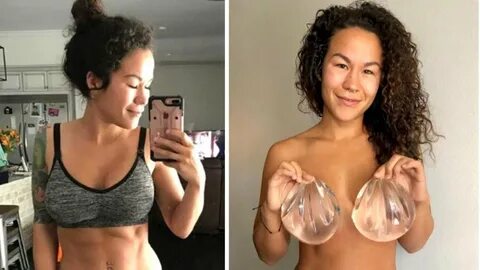 Why do girls get boob implants reddit