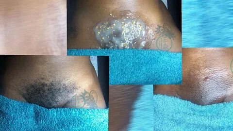 Brazilian Wax and Vajacial (Before & After Pictures) - YouTu