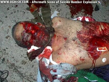 ogrish-dot-com-suicide_bomber_explosion_aftermath6.jpg (imag