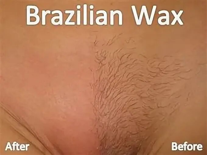 Brazilian Wax Before And After Pictures - Ikable Online