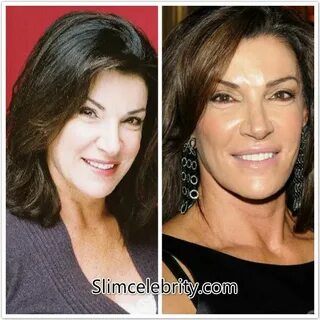 Hilary Farr Plastic Surgery Before and After http://slimcele