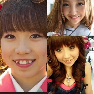 Japanese girls cover their teeth