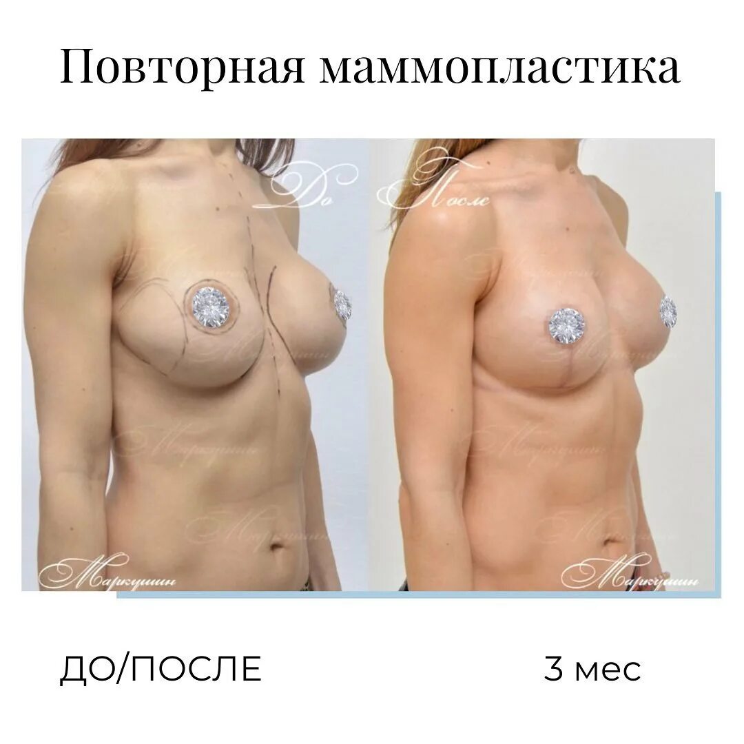грудь беременной на начальной стадии фото 22