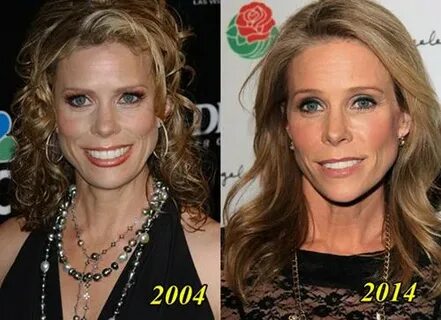 Cheryl Hines Plastic Surgery Before and After - Plastic Surg