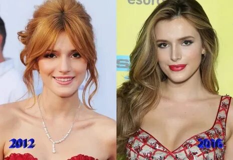 Bella Thorne Plastic Surgery - Celebrities plastic surgery