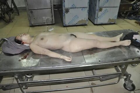 Big: Autopsy collection of women and girls - update - Page 3