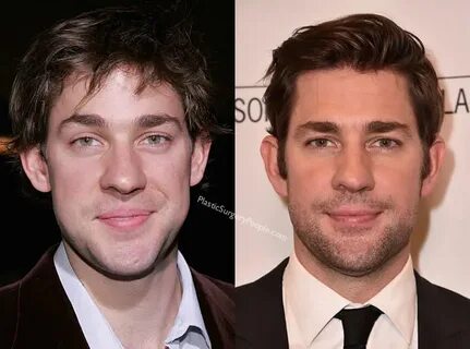 John Krasinski Did NOT Have Nose Job and Here's Proof