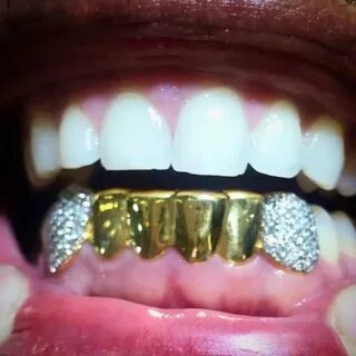 Custom 6 OR 8 Teeth Solid Gold Grillz with Diamond Fangs Gol