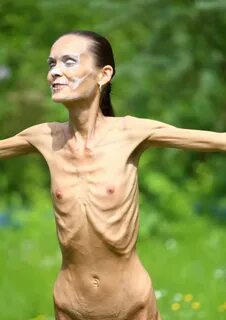 Pictures of anorexic nude girls