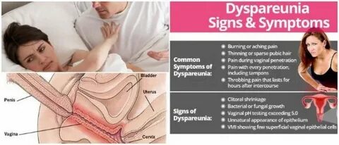 Dyspareunia: Definition, Causes, Symptoms and Treatment - Ho