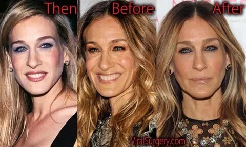 Sarah Jessica Parker Plastic Surgery: Before and After Boob 