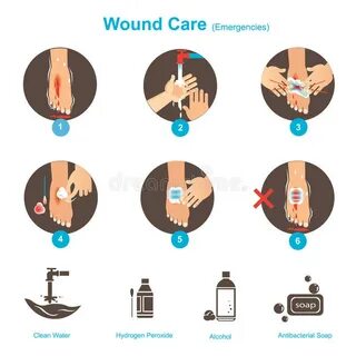 Hydrogen Peroxide Skin Stock Illustrations - 18 Hydrogen Per