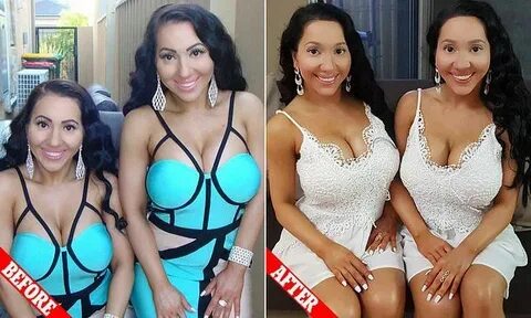 Twins who spent THOUSANDS on plastic surgery debut their new
