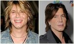 John Rzeznik Plastic Surgery Before and After Plastic surger