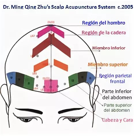 8 Zhu's Scalp ideas acupuncture, acupunture, scalps