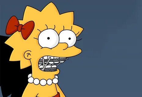 The Best Braces Moments in Pop-Culture History Fresh Orthodo