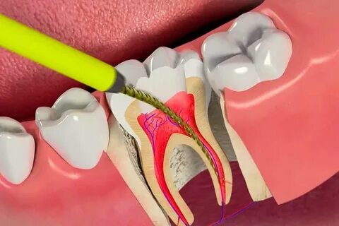Mund-und Zahngesundheit Medgo Life