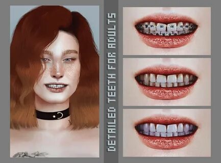Magic-Bot’s Detailed Teeth - Sweet Sims 4 Finds Sims 4, Sims