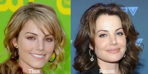 Erica Durance Plastic Surgery Before and After Photos - Late