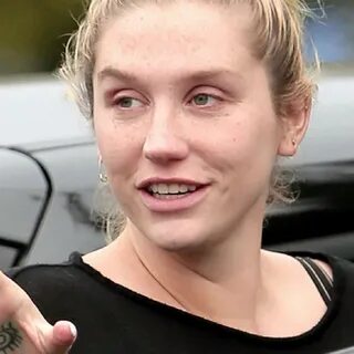 Shocking Photos of Celebrities Without Cosmetic Makeup Suppo