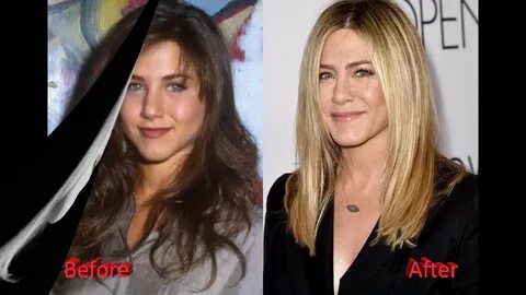 Jennifer Aniston Nose Job Plastic Surgery Before and After -
