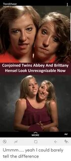 Trendchaser Iry Not to Cry a Conjoined Twins Abbey and Britt