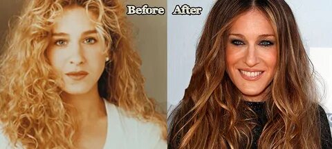 Sarah Jessica Parker Plastic Surgery Before and After Bad Pl